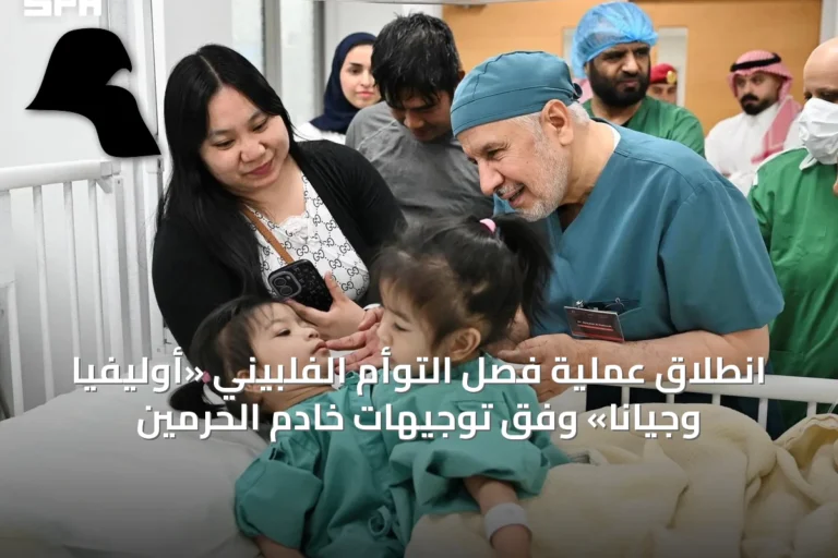 انطلاق عملية فصل التوأم الفلبيني «أوليفيا وجيانا» وفق توجيهات خادم الحرمين