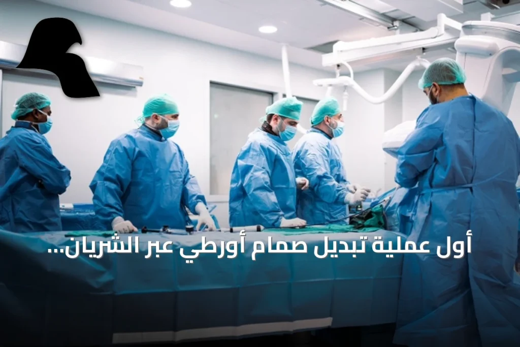 أول عملية تبديل صمام أورطي عبر الشريان السباتي في الشرق الأوسط تُجرى بمستشفى جابر الأحمد