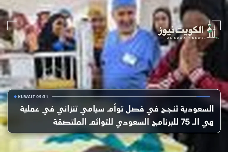 السعودية تنجح في فصل توأم سيامي تنزاني في عملية هي الـ 75 للبرنامج السعودي للتوائم الملتصقة