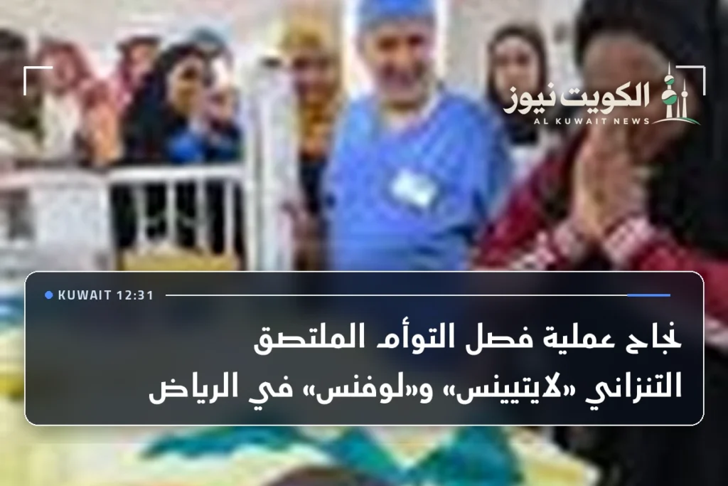 نجاح عملية فصل التوأم الملتصق التنزاني «لايتيينس» و«لوفنس» في الرياض