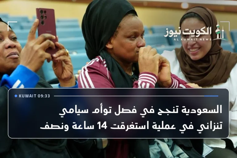 السعودية تنجح في فصل توأم سيامي تنزاني في عملية استغرقت 14 ساعة ونصف